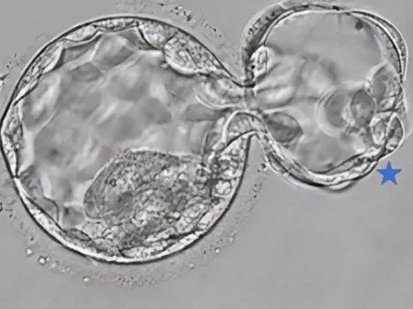 3ab