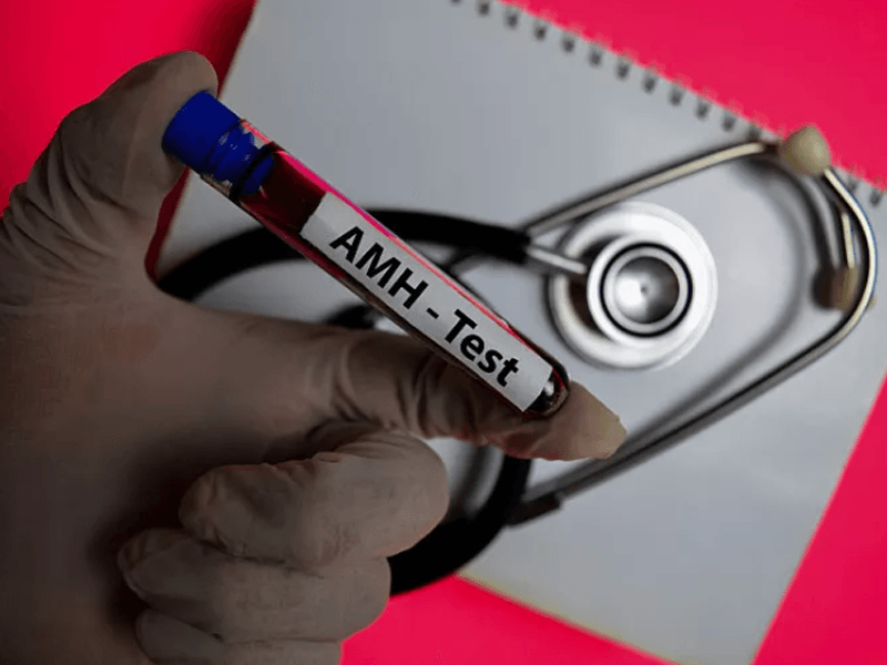 AMH