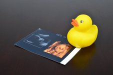促排卵期间可以喝中药方子调理身体吗？会起冲突吗？